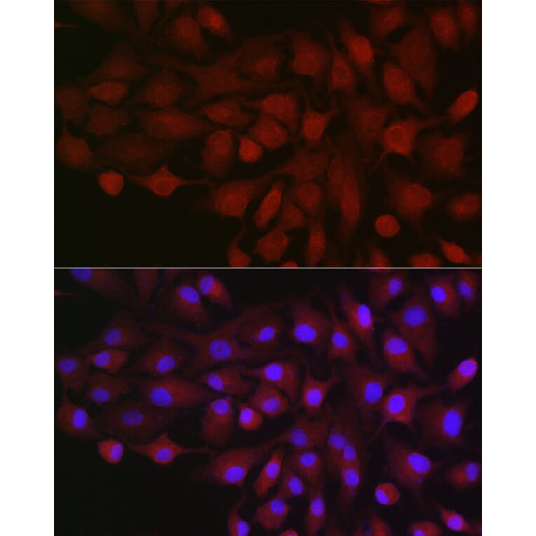 Immunofluorescence - Anti-B1R Antibody (A89588) - Antibodies.com