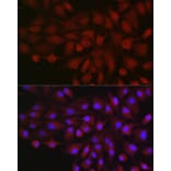 Immunofluorescence - Anti-B1R Antibody (A89588) - Antibodies.com