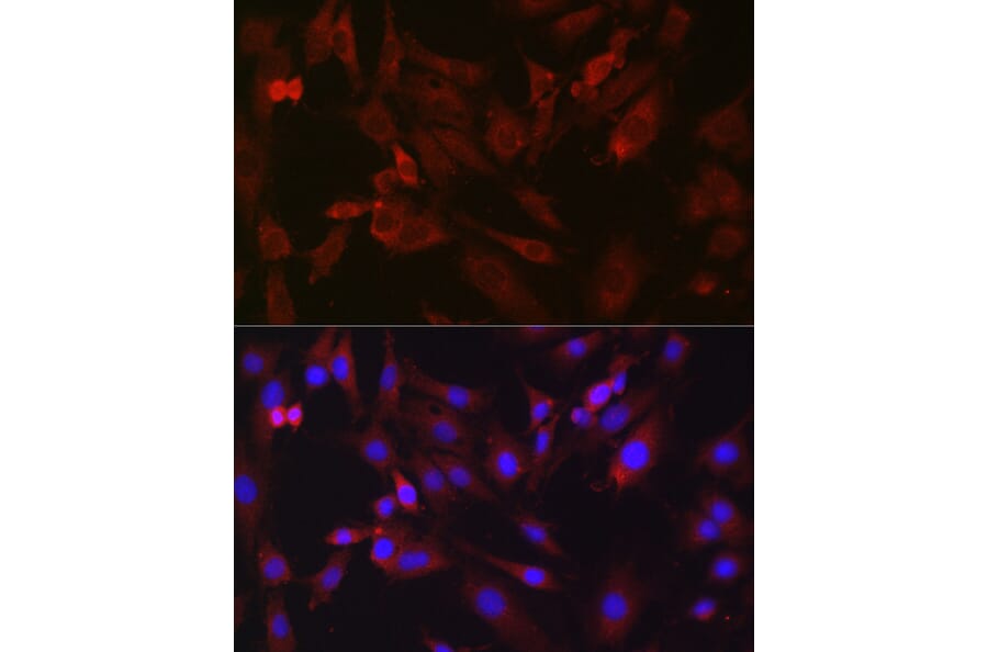 Immunofluorescence - Anti-B1R Antibody (A89588) - Antibodies.com