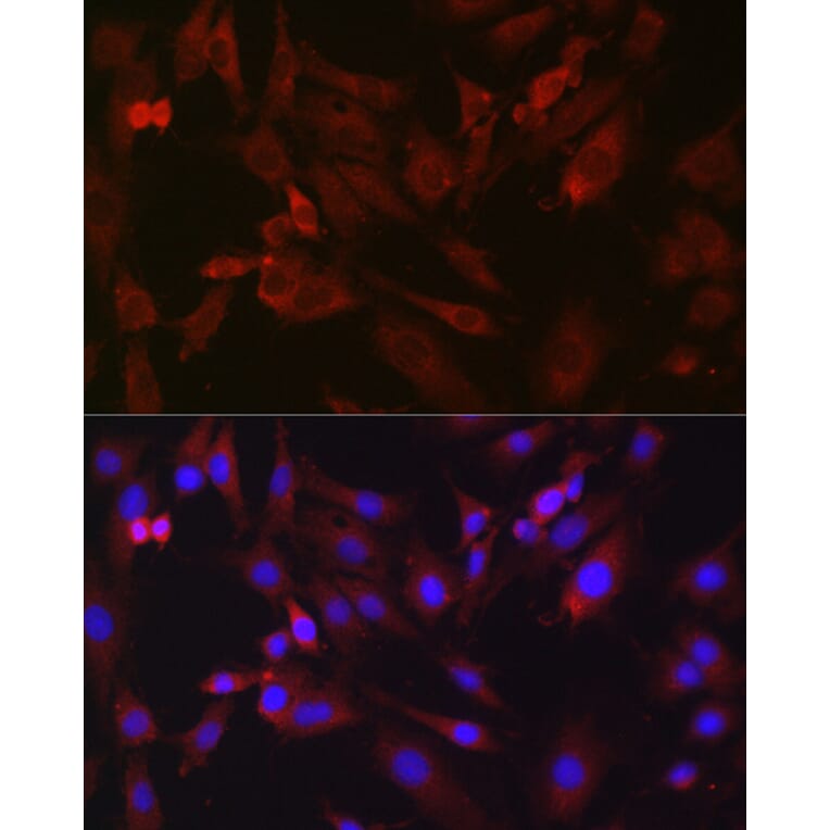 Immunofluorescence - Anti-B1R Antibody (A89588) - Antibodies.com