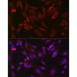 Immunofluorescence - Anti-B1R Antibody (A89588) - Antibodies.com