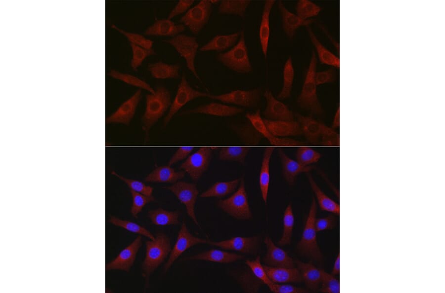 Immunofluorescence - Anti-B1R Antibody (A89588) - Antibodies.com