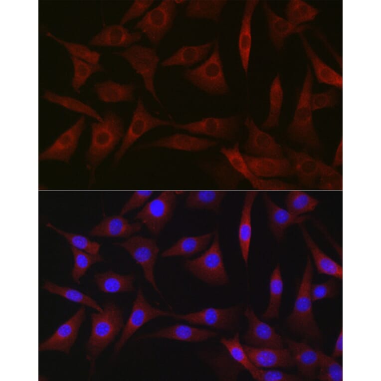 Immunofluorescence - Anti-B1R Antibody (A89588) - Antibodies.com