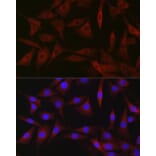 Immunofluorescence - Anti-B1R Antibody (A89588) - Antibodies.com