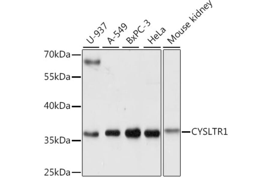 Western Blot - Anti-CysLT1 Antibody (A89589) - Antibodies.com