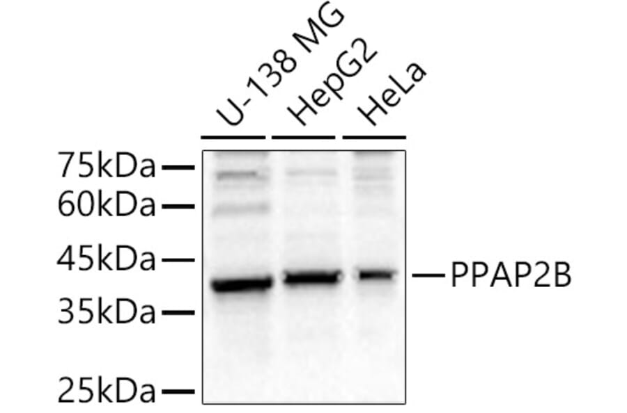 Western Blot - Anti-Phosphatidic acid phosphatase type 2B Antibody (A89590) - Antibodies.com