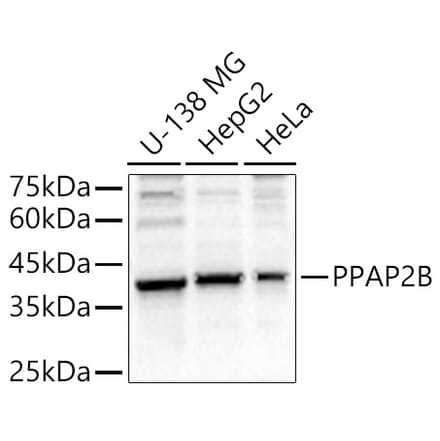 Western Blot - Anti-Phosphatidic acid phosphatase type 2B Antibody (A89590) - Antibodies.com