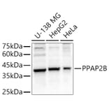 Western Blot - Anti-Phosphatidic acid phosphatase type 2B Antibody (A89590) - Antibodies.com