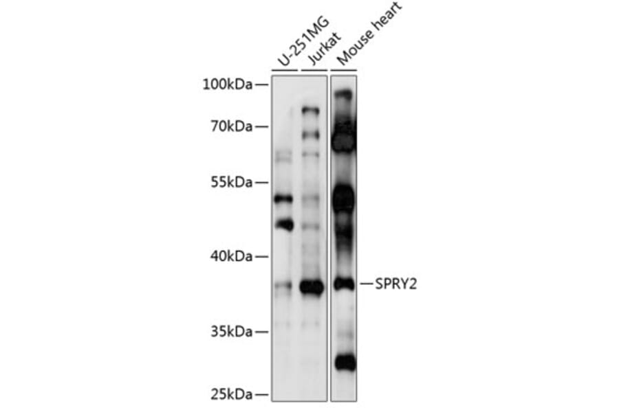 Western Blot - Anti-SPRY2 Antibody (A89591) - Antibodies.com