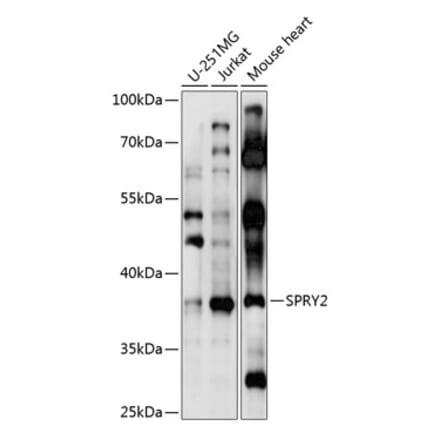 Western Blot - Anti-SPRY2 Antibody (A89591) - Antibodies.com