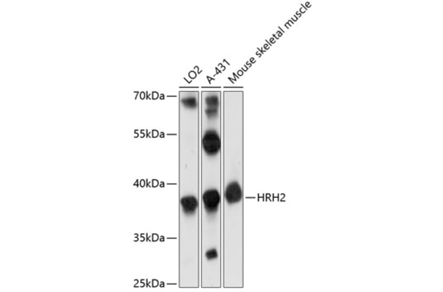 Western Blot - Anti-H2R Antibody (A89593) - Antibodies.com