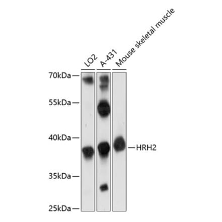Western Blot - Anti-H2R Antibody (A89593) - Antibodies.com
