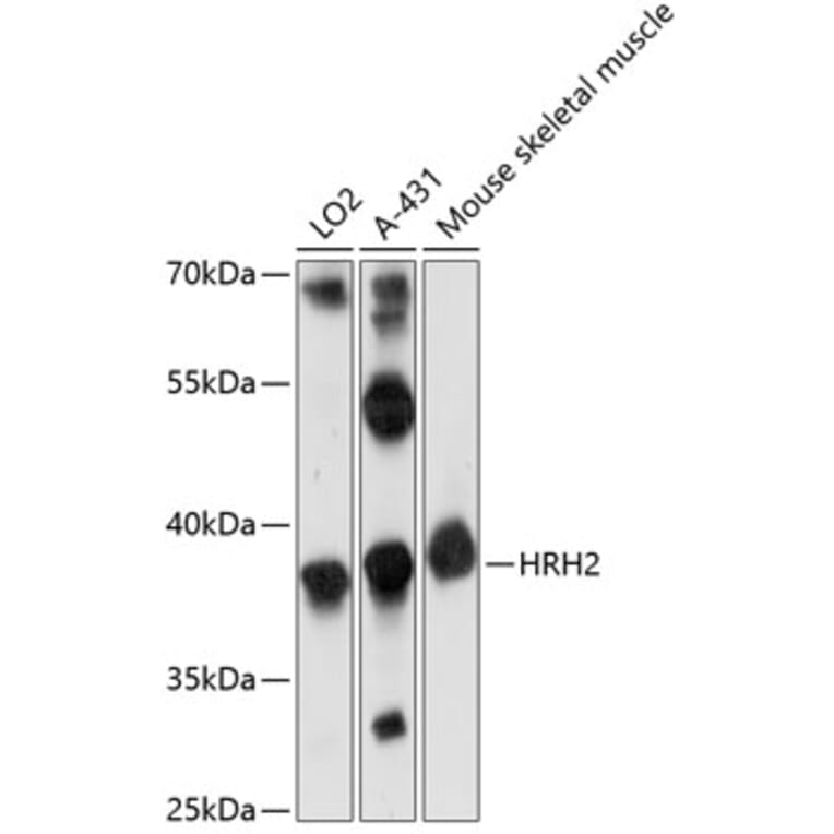 Western Blot - Anti-H2R Antibody (A89593) - Antibodies.com