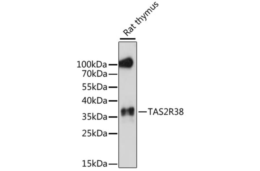 Western Blot - Anti-TAS2R38 Antibody (A89594) - Antibodies.com