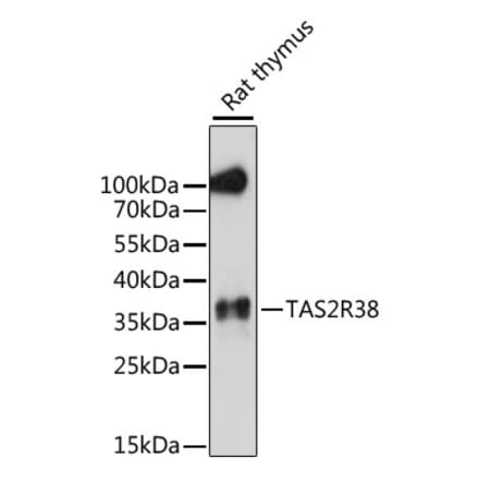 Western Blot - Anti-TAS2R38 Antibody (A89594) - Antibodies.com