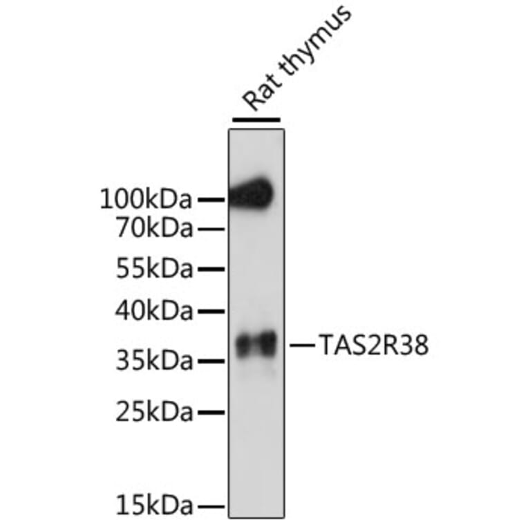 Western Blot - Anti-TAS2R38 Antibody (A89594) - Antibodies.com