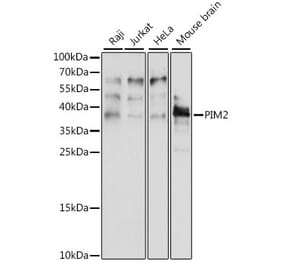 Western Blot - Anti-PIM2 Antibody (A89595) - Antibodies.com