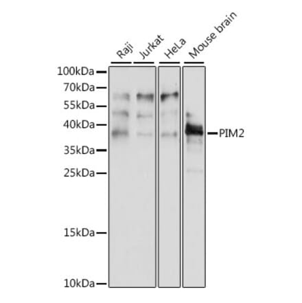 Western Blot - Anti-PIM2 Antibody (A89595) - Antibodies.com