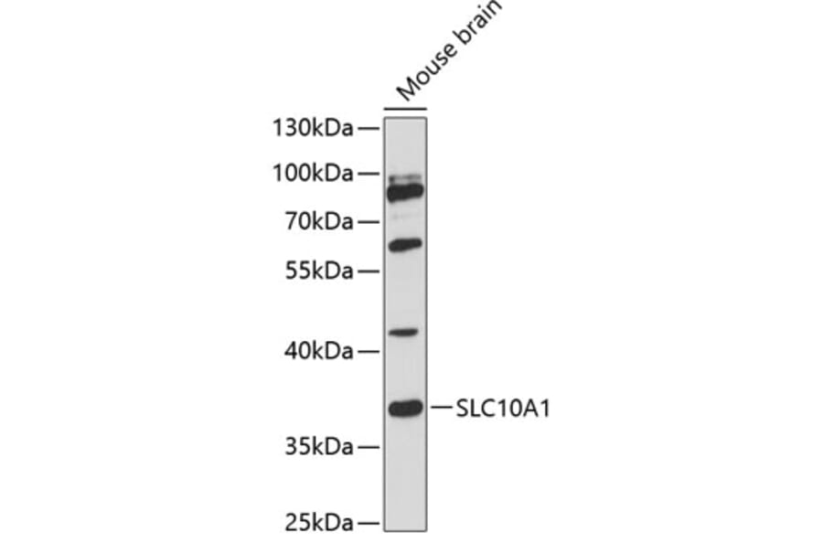Western Blot - Anti-SLC10A1/NTCP1 Antibody (A89596) - Antibodies.com