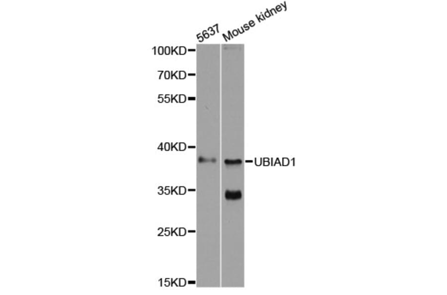Western Blot - Anti-UBIAD1 Antibody (A13421) - Antibodies.com