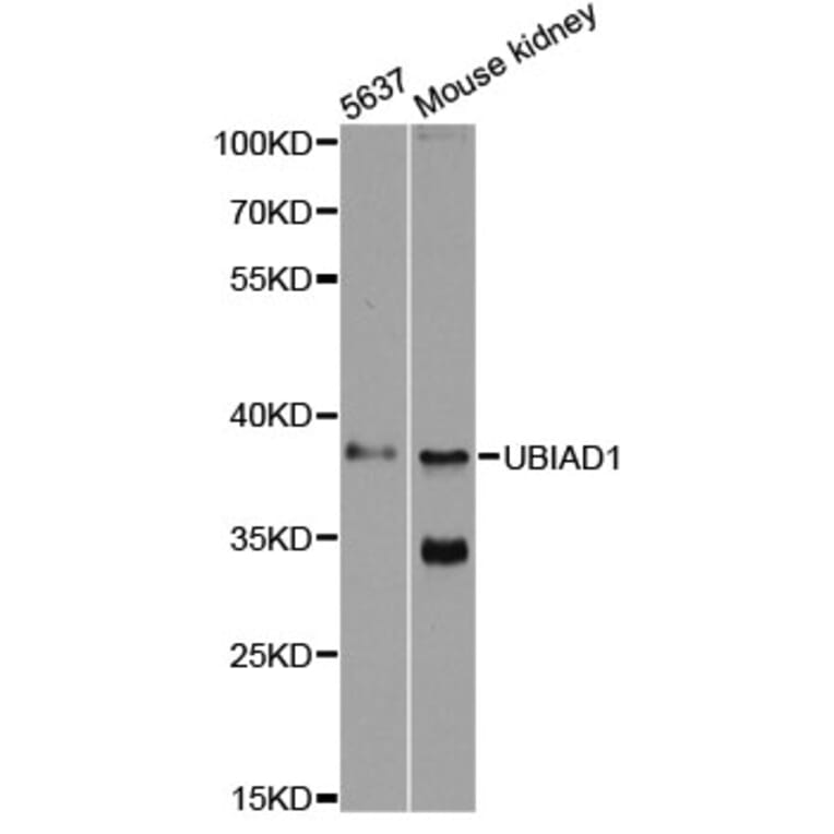 Western Blot - Anti-UBIAD1 Antibody (A13421) - Antibodies.com