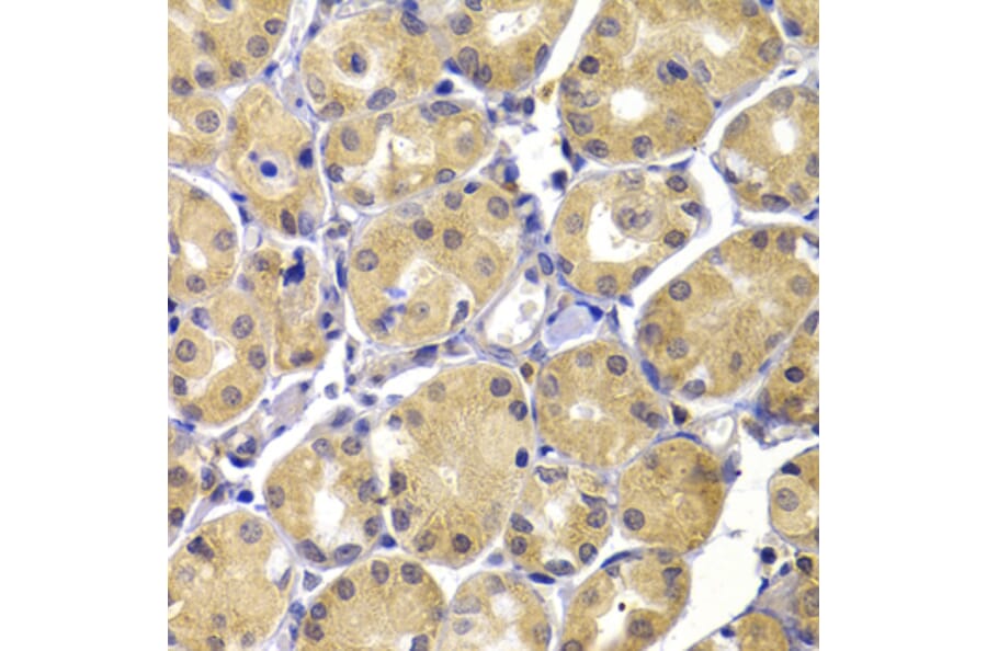 Immunohistochemistry - Anti-UBIAD1 Antibody (A13421) - Antibodies.com