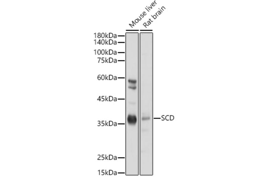 Western Blot - Anti-SCD1 Antibody (A89598) - Antibodies.com