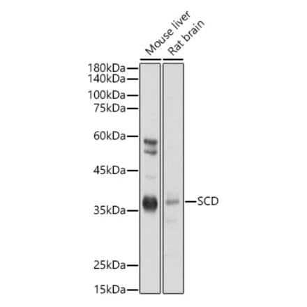 Western Blot - Anti-SCD1 Antibody (A89598) - Antibodies.com