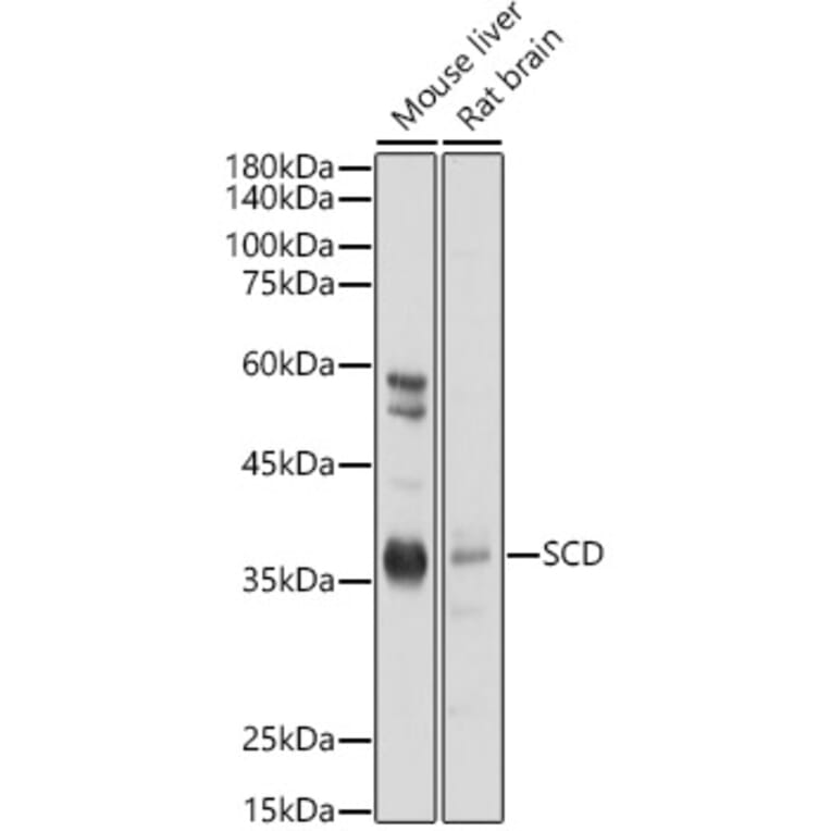 Western Blot - Anti-SCD1 Antibody (A89598) - Antibodies.com