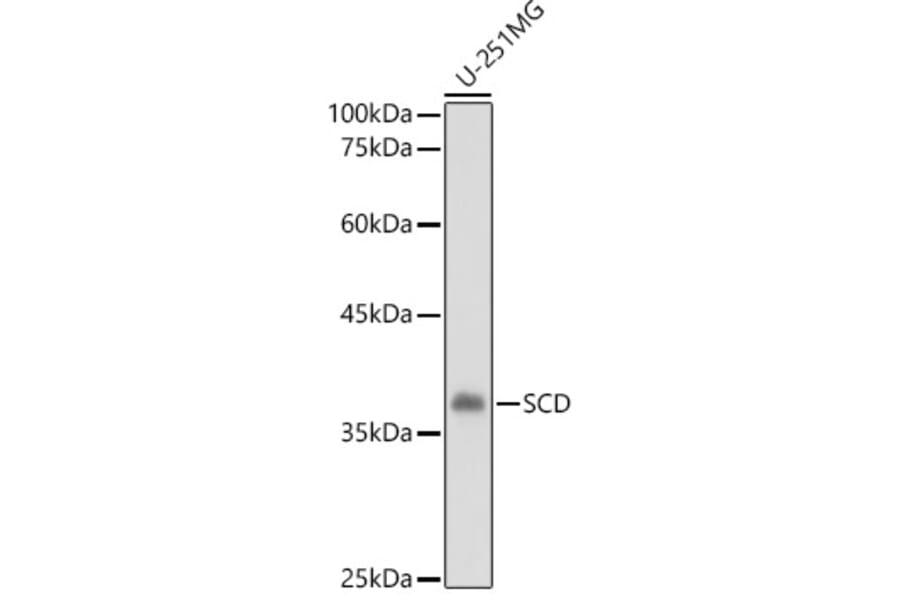 Western Blot - Anti-SCD1 Antibody (A89598) - Antibodies.com