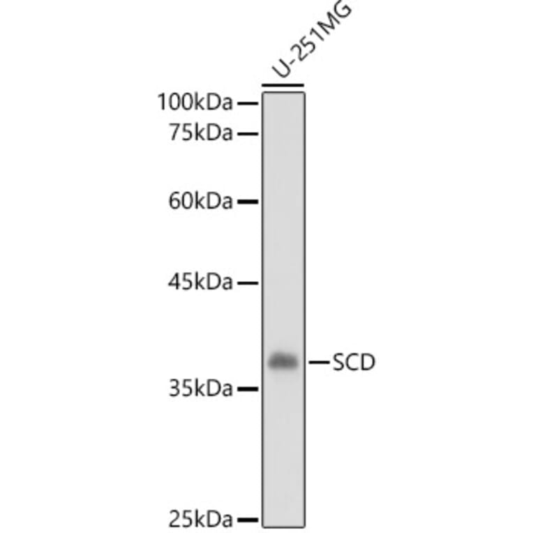 Western Blot - Anti-SCD1 Antibody (A89598) - Antibodies.com