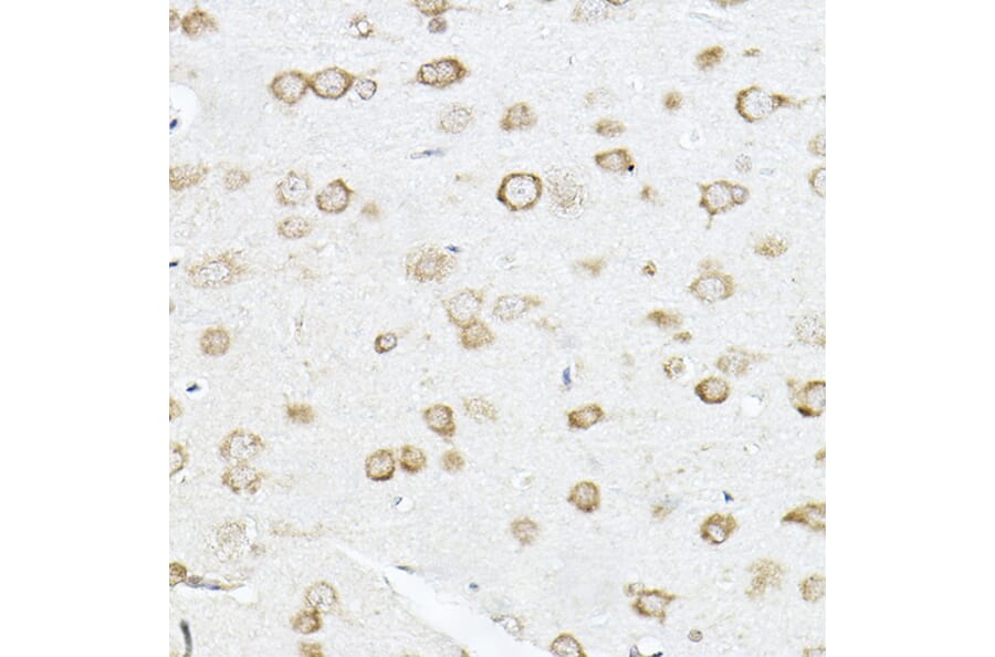 Immunohistochemistry - Anti-SCD1 Antibody (A89598) - Antibodies.com