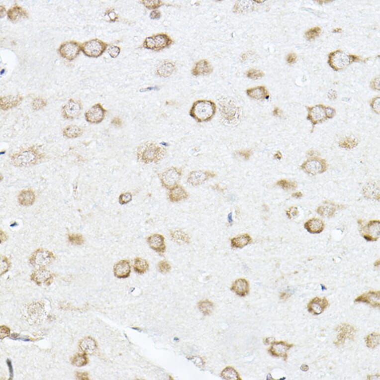Immunohistochemistry - Anti-SCD1 Antibody (A89598) - Antibodies.com
