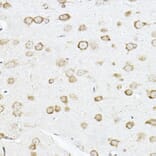 Immunohistochemistry - Anti-SCD1 Antibody (A89598) - Antibodies.com