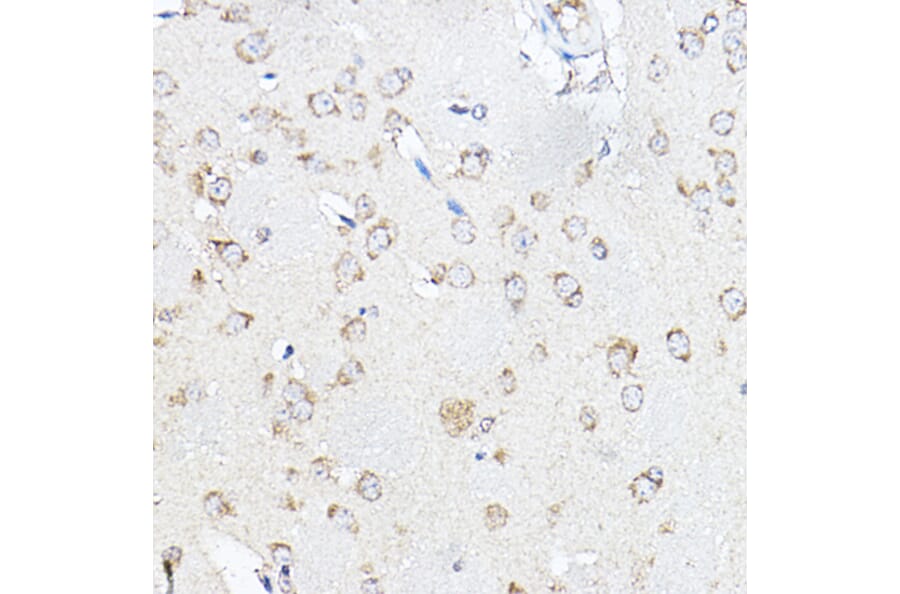 Immunohistochemistry - Anti-SCD1 Antibody (A89598) - Antibodies.com