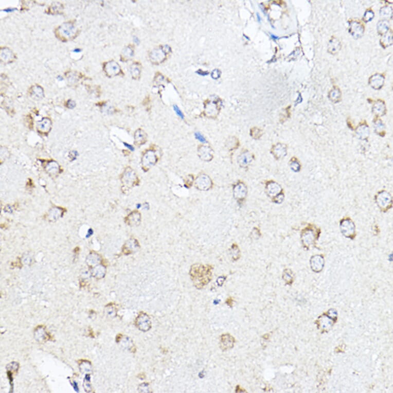 Immunohistochemistry - Anti-SCD1 Antibody (A89598) - Antibodies.com