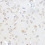 Immunohistochemistry - Anti-SCD1 Antibody (A89598) - Antibodies.com