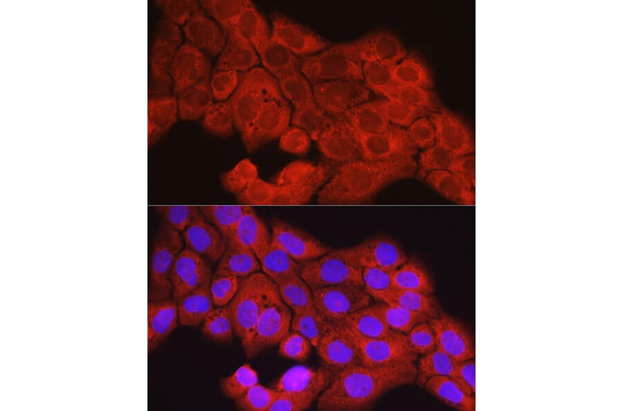 Immunofluorescence - Anti-SCD1 Antibody (A89598) - Antibodies.com