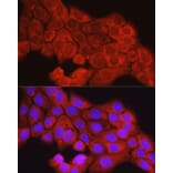 Immunofluorescence - Anti-SCD1 Antibody (A89598) - Antibodies.com