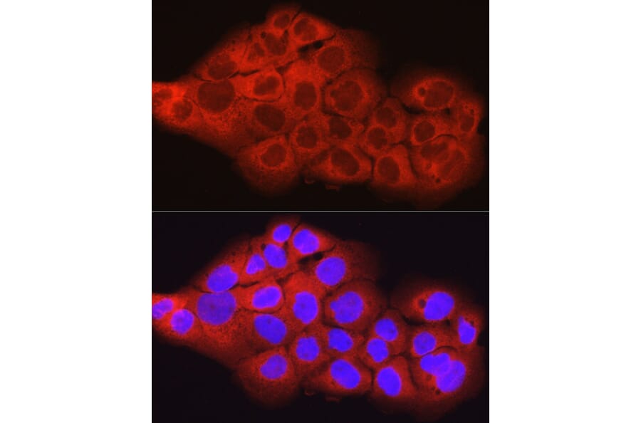 Immunofluorescence - Anti-SCD1 Antibody (A89598) - Antibodies.com