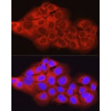 Immunofluorescence - Anti-SCD1 Antibody (A89598) - Antibodies.com