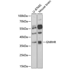 Western Blot - Anti-GnRHR Antibody (A89599) - Antibodies.com