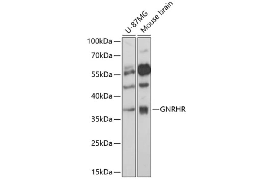Western Blot - Anti-GnRHR Antibody (A89599) - Antibodies.com
