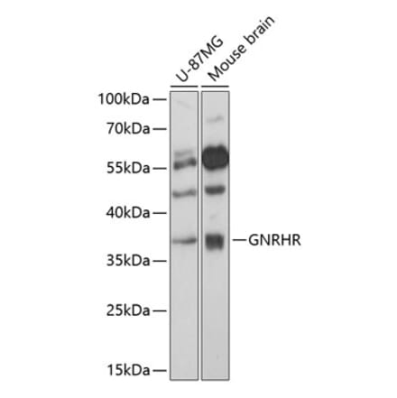 Western Blot - Anti-GnRHR Antibody (A89599) - Antibodies.com