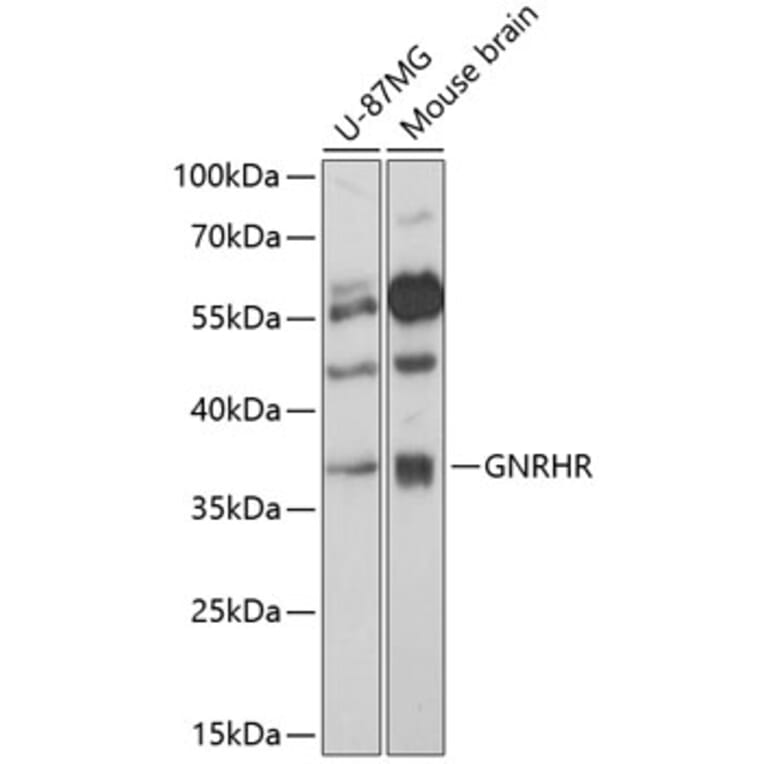 Western Blot - Anti-GnRHR Antibody (A89599) - Antibodies.com