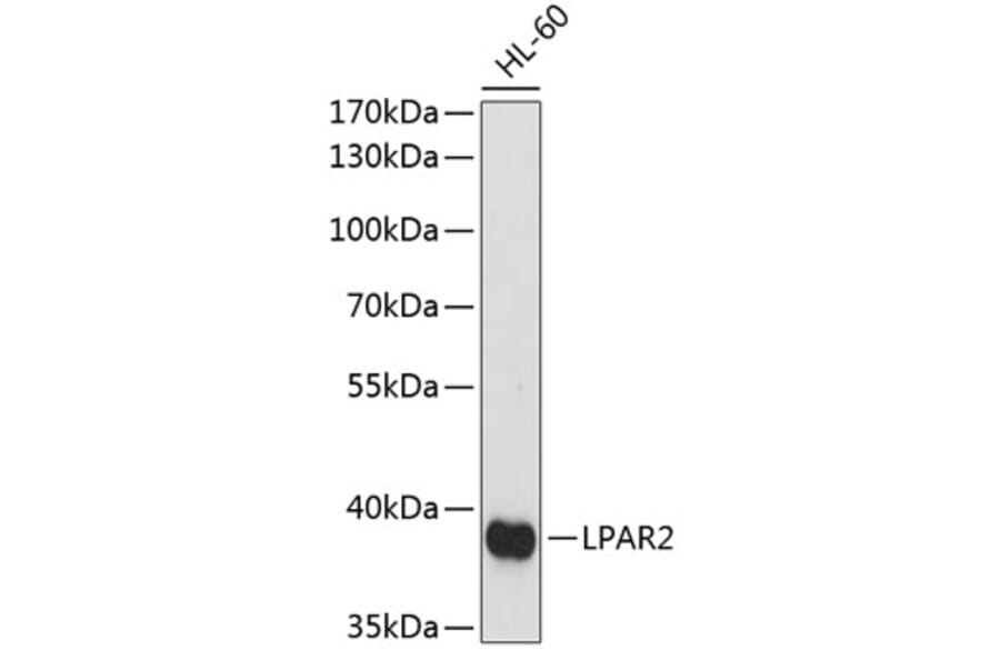 Western Blot - Anti-LPA-2 Antibody (A89600) - Antibodies.com