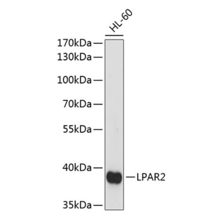 Western Blot - Anti-LPA-2 Antibody (A89600) - Antibodies.com