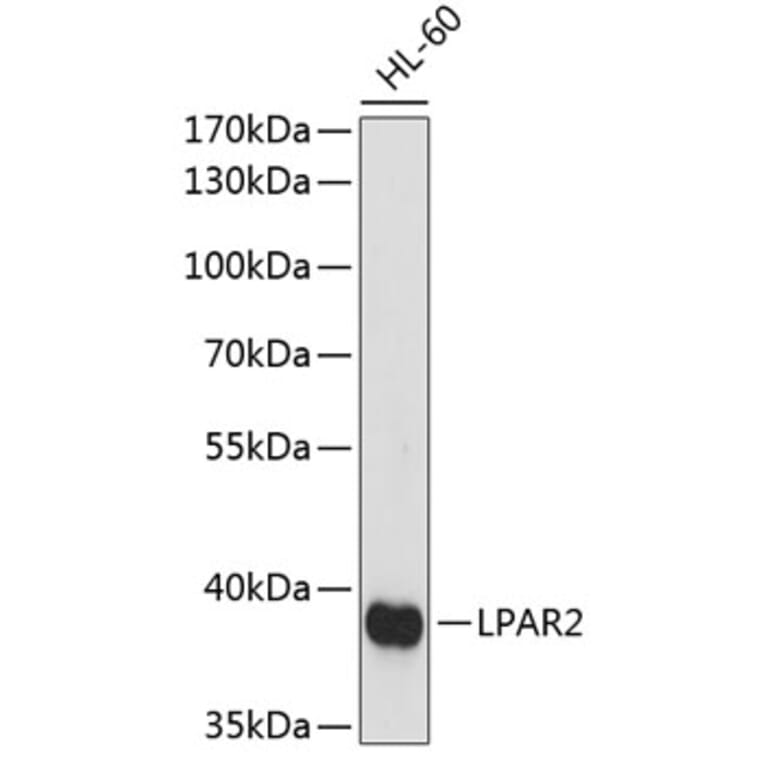 Western Blot - Anti-LPA-2 Antibody (A89600) - Antibodies.com