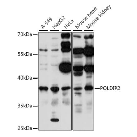 Western Blot - Anti-POLDIP2 Antibody (A89601) - Antibodies.com