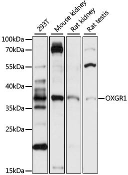 Western blot analysis of extracts of various cell lines, using Anti-OXGR1 Antibody (A15431) at 1:1,000 dilution.
Secondary antibody: Goat Anti-Rabbit IgG (H+L) (HRP) (AS014) at 1:10,000 dilution.
Lysates / proteins: 25µg per lane.
Blocking buffer: 3% non-fat dry milk in TBST.
Detection: ECL Basic Kit (RM00020).
Exposure time: 10s.